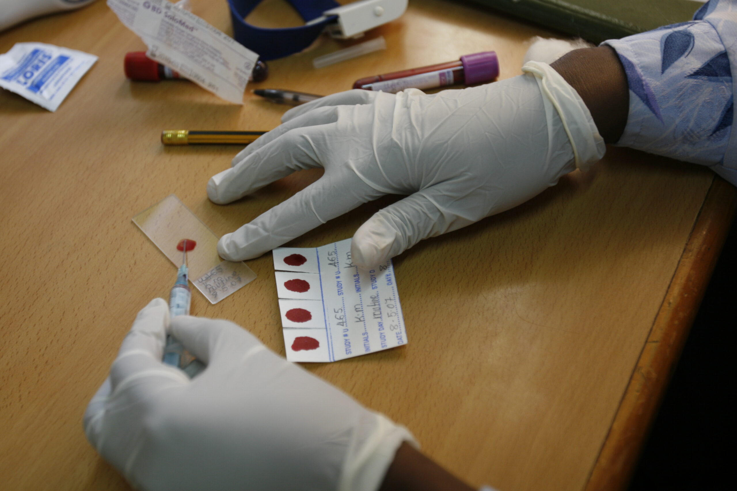 Image of gloved hands placing blood samples on microscope glass